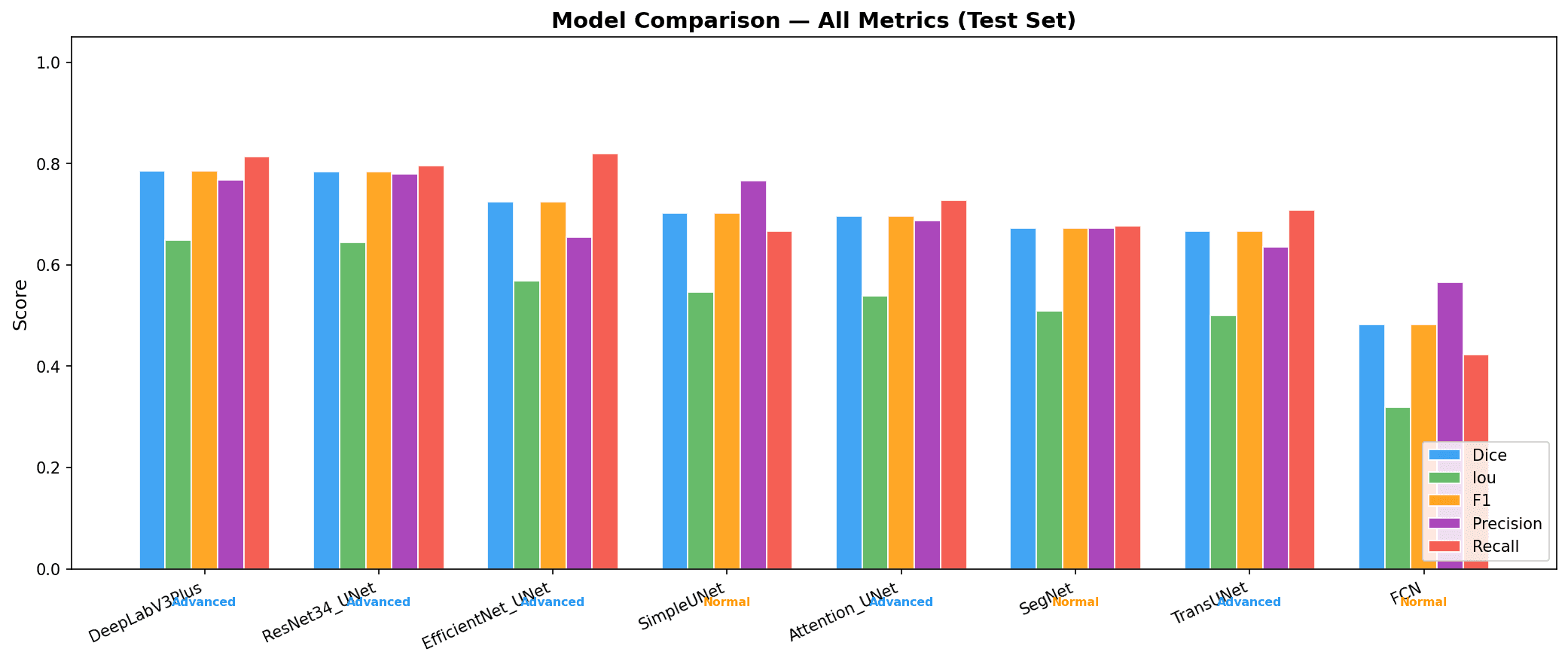 Benchmark — Dice, IoU, F1, Precision, Recall across 9 models