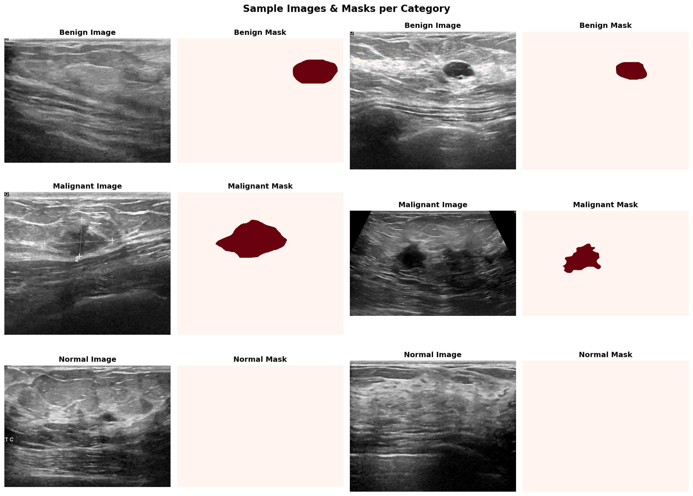 Sample ultrasound images with ground-truth segmentation masks (all 3 classes)