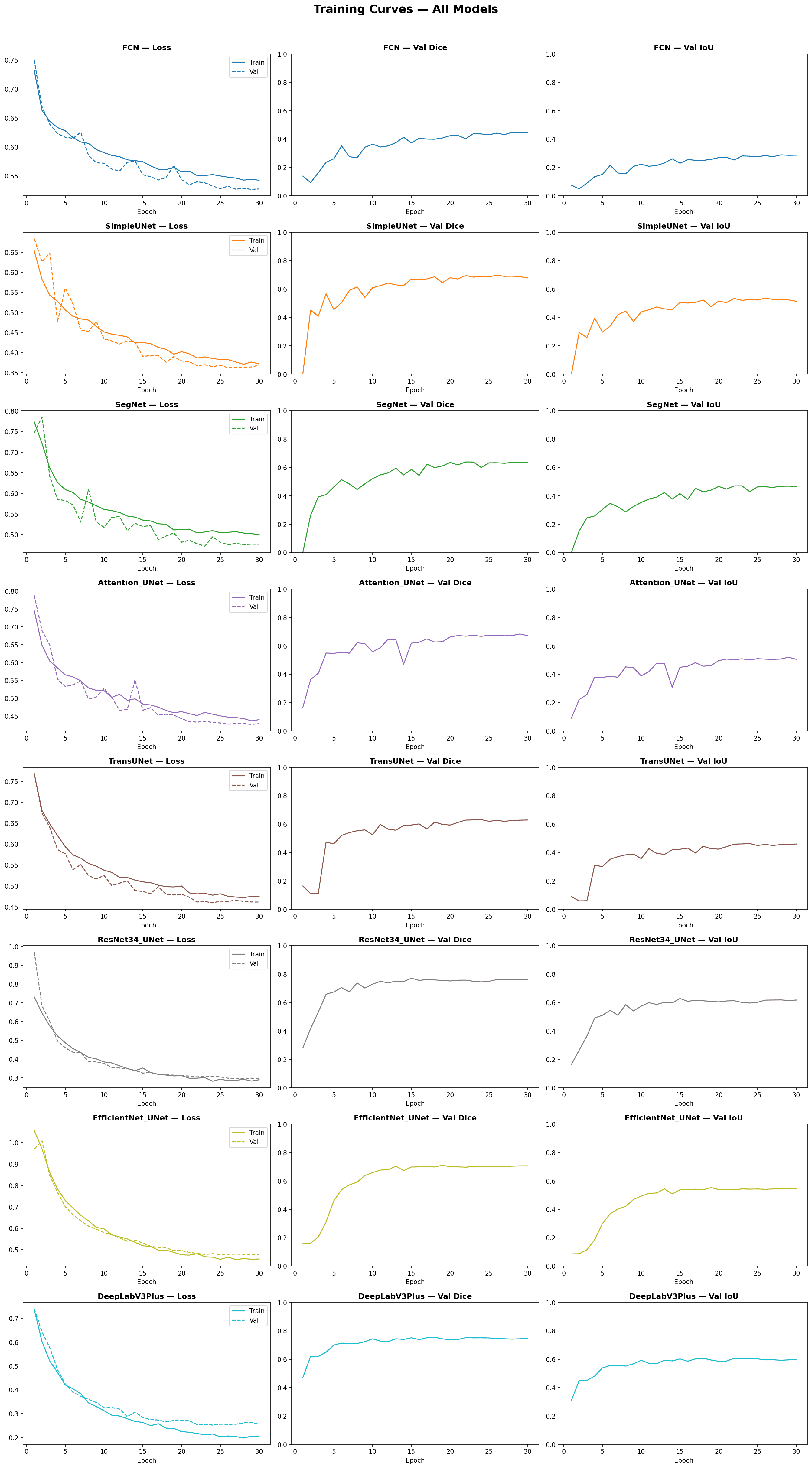 Training loss & Dice/IoU curves — all 9 architectures over 30 epochs